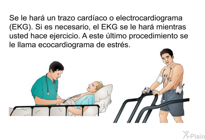 Se le har un trazo cardaco o electrocardiograma (EKG). Si es necesario, el EKG se le har mientras usted hace ejercicio. A este ltimo procedimiento se le llama ecocardiograma de estrs.