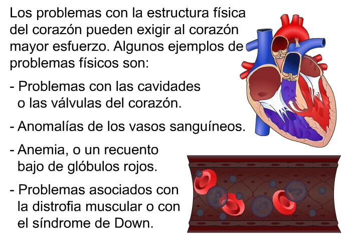 Los problemas con la estructura fsica del corazn pueden exigir al corazn mayor esfuerzo. Algunos ejemplos de problemas fsicos son:  Problemas con las cavidades o las vlvulas del corazn. Anomalas de los vasos sanguneos. Anemia, o un recuento bajo de glbulos rojos. Problemas asociados con la distrofia muscular o con el sndrome de Down.