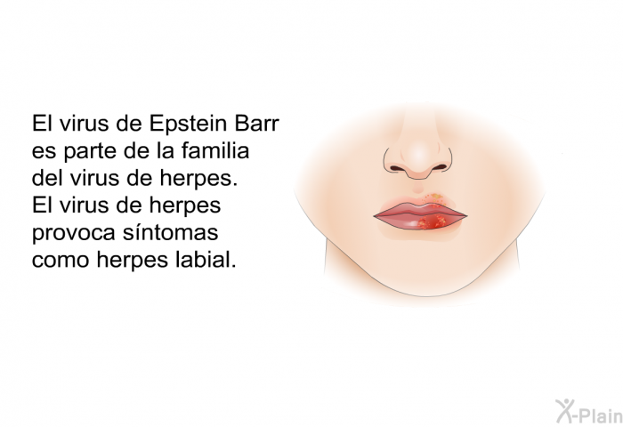 El virus de Epstein Barr es parte de la familia del virus de herpes. El virus de herpes provoca sntomas como herpes labial.
