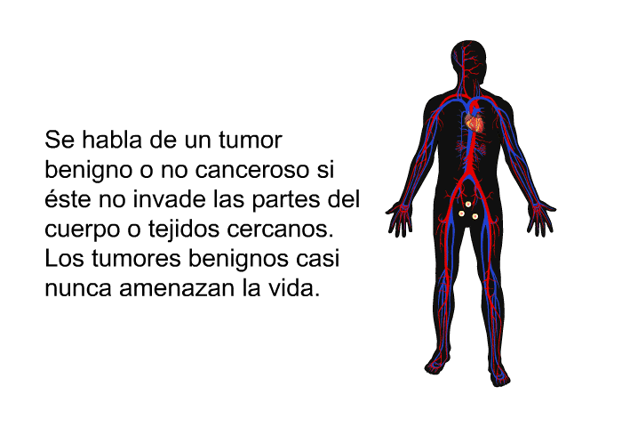 Se habla de un tumor benigno o no canceroso si ste no invade las partes del cuerpo o tejidos cercanos. Los tumores benignos casi nunca amenazan la vida.