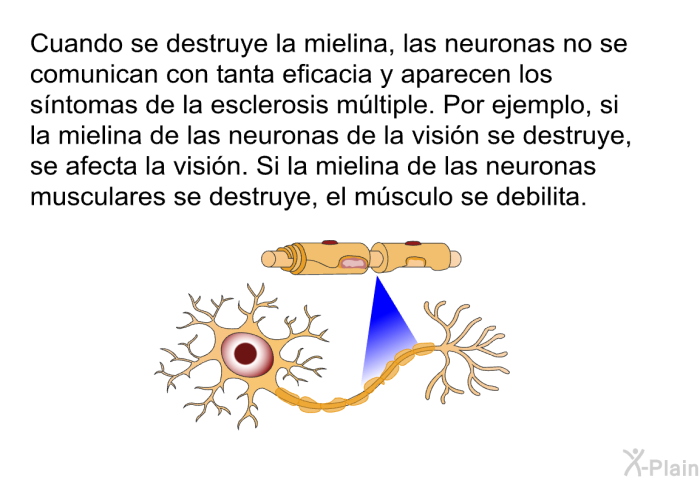 Cuando se destruye la mielina, las neuronas no se comunican con tanta eficacia y aparecen los sntomas de la esclerosis mltiple. Por ejemplo, si la mielina de las neuronas de la visin se destruye, se afecta la visin. Si la mielina de las neuronas musculares se destruye, el msculo se debilita.