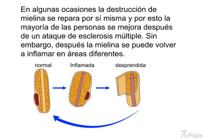 En algunas ocasiones la destruccin de mielina se repara por s misma y por esto la mayora de las personas se mejora despus de un ataque de esclerosis mltiple. Sin embargo, despus la mielina se puede volver a inflamar en reas diferentes.