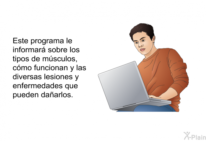 Esta informacin acerca de su salud le informar sobre los tipos de msculos, cmo funcionan y las diversas lesiones y enfermedades que pueden daarlos.