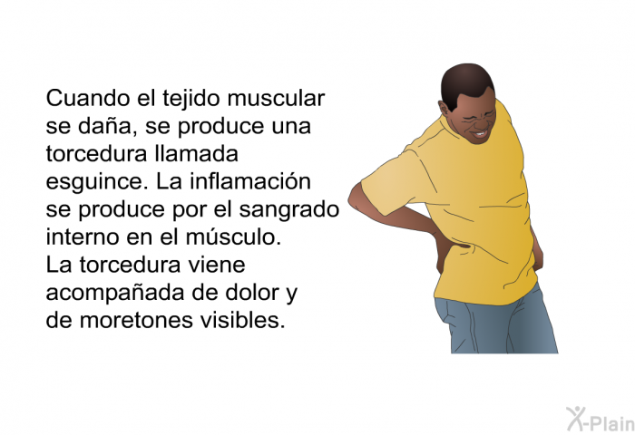Cuando el tejido muscular se daa, se produce una torcedura llamada esguince. La inflamacin se produce por el sangrado interno en el msculo. La torcedura viene acompaada de dolor y de moretones visibles.