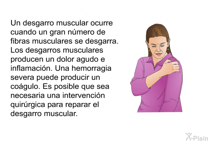 Un desgarro muscular ocurre cuando un gran nmero de fibras musculares se desgarra. Los desgarros musculares producen un dolor agudo e inflamacin. Una hemorragia severa puede producir un cogulo. Es posible que sea necesaria una intervencin quirrgica para reparar el desgarro muscular.