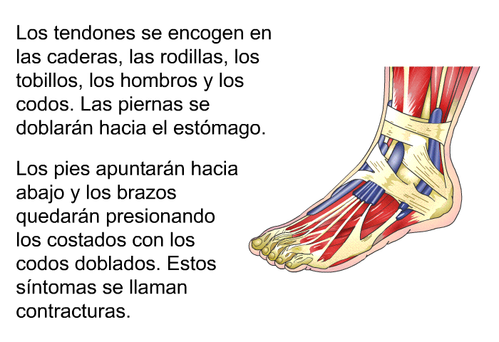 PatEdu.com : muscular Duchenne