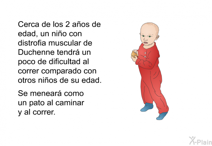 Cerca de los 2 aos de edad, un nio con distrofia muscular de Duchenne tendr un poco de dificultad al correr comparado con otros nios de su edad. Se menear como un pato al caminar y al correr.