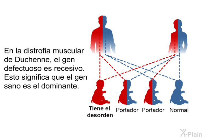 En la distrofia muscular de Duchenne, el gen defectuoso es recesivo. Esto significa que el gen sano es el dominante.