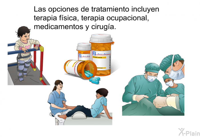 Las opciones de tratamiento incluyen terapia f�sica, terapia ocupacional, medicamentos y cirug�a.