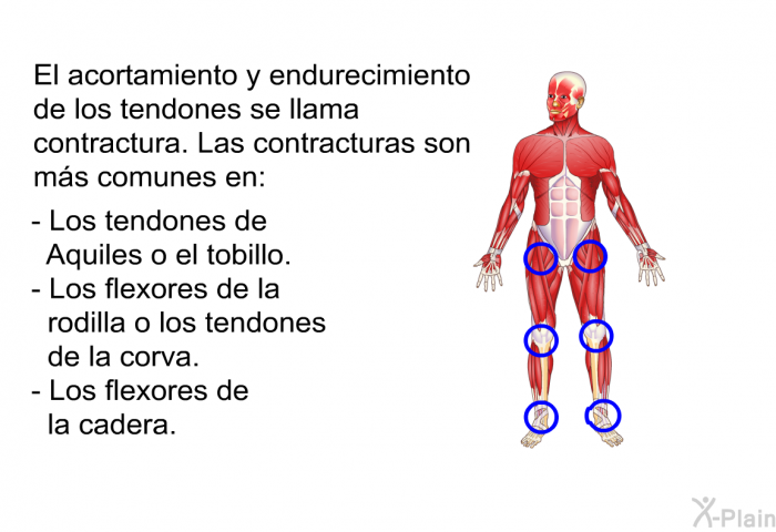 El acortamiento y endurecimiento de los tendones se llama contractura. Las contracturas son m�s comunes en:  Los tendones de Aquiles o el tobillo. Los flexores de la rodilla o los tendones de la corva. Los flexores de la cadera.