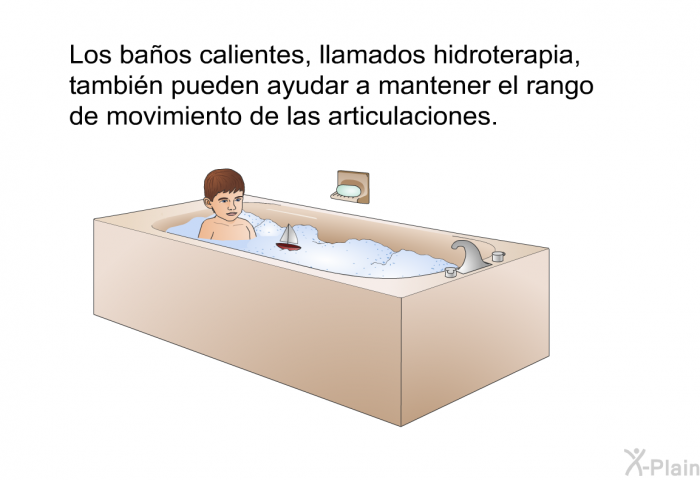 Los ba�os calientes, llamados hidroterapia, tambi�n pueden ayudar a mantener el rango de movimiento de las articulaciones.