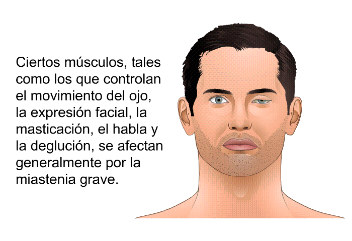 Ciertos msculos, tales como los que controlan el movimiento del ojo, la expresin facial, la masticacin, el habla y la deglucin, se afectan generalmente por la miastenia grave.