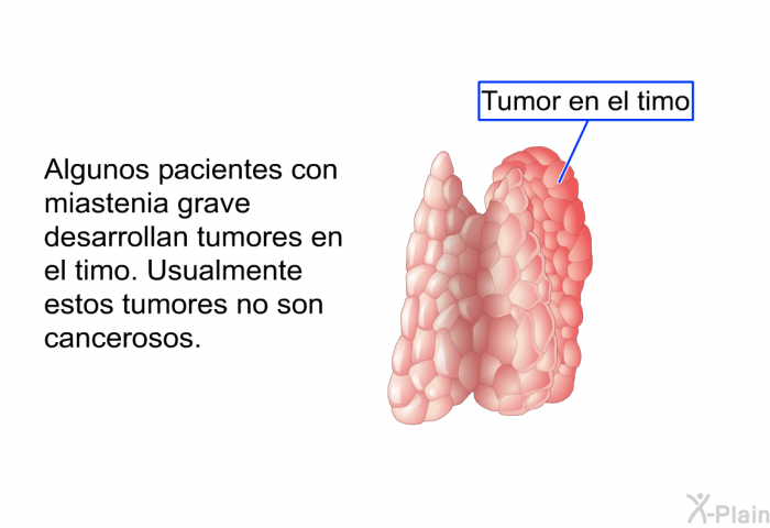 Algunos pacientes con miastenia grave desarrollan tumores en el timo. Usualmente estos tumores no son cancerosos.