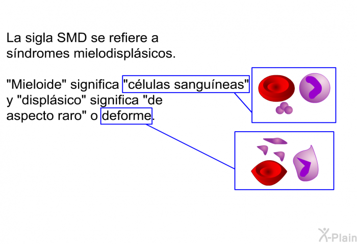 La sigla SMD se refiere a sndromes mielodisplsicos. “Mieloide” significa “clulas sanguneas” y “displsico” significa “de aspecto raro” o deforme.