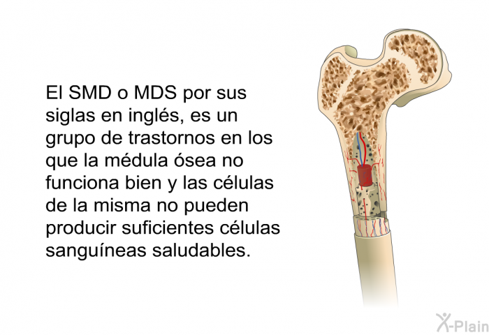 El SMD o MDS por sus siglas en ingls, es un grupo de trastornos en los que la mdula sea no funciona bien y las clulas de la misma no pueden producir suficientes clulas sanguneas saludables.