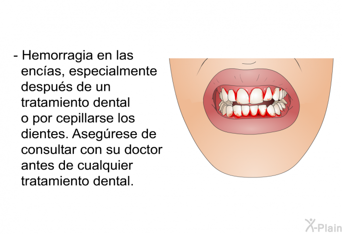 Hemorragia en las enc�as, especialmente despu�s de un tratamiento dental o por cepillarse los dientes. Aseg�rese de consultar con su doctor antes de cualquier tratamiento dental.