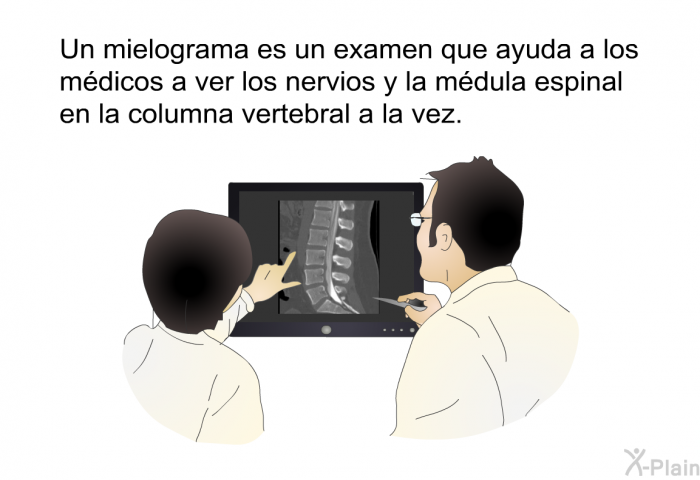 Un mielograma es un examen que ayuda a los mdicos a ver los nervios y la mdula espinal en la columna vertebral a la vez.