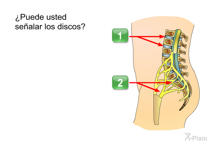 ¿Puede usted sealar los discos?