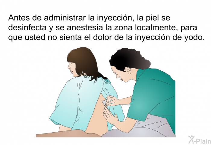Antes de administrar la inyeccin, la piel se desinfecta y se anestesia la zona localmente, para que usted no sienta el dolor de la inyeccin de yodo.