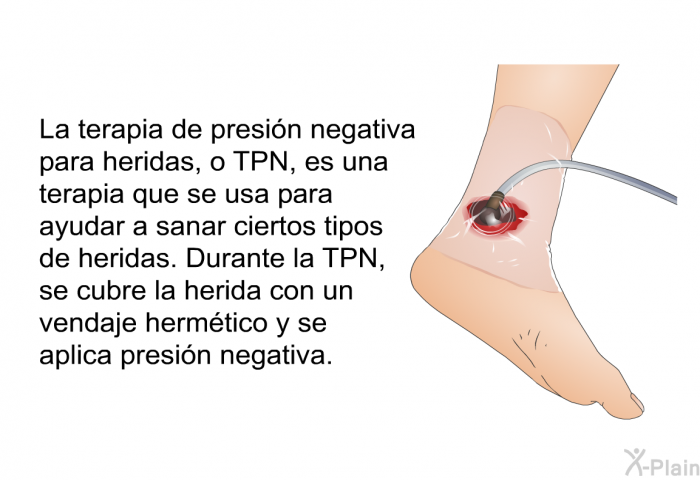 La terapia de presin negativa para heridas, o TPN, es una terapia que se usa para ayudar a sanar ciertos tipos de heridas. Durante la TPN, se cubre la herida con un vendaje hermtico y se aplica presin negativa.