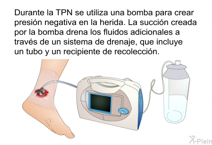 Durante la TPN se utiliza una bomba para crear presin negativa en la herida. La succin creada por la bomba drena los fluidos adicionales a travs de un sistema de drenaje, que incluye un tubo y un recipiente de recoleccin.