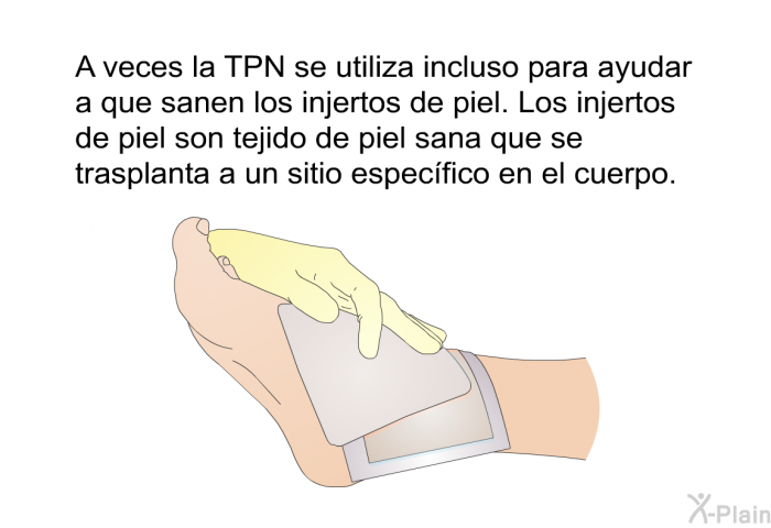 A veces la TPN se utiliza incluso para ayudar a que sanen los injertos de piel. Los injertos de piel son tejido de piel sana que se trasplanta a un sitio especfico en el cuerpo.