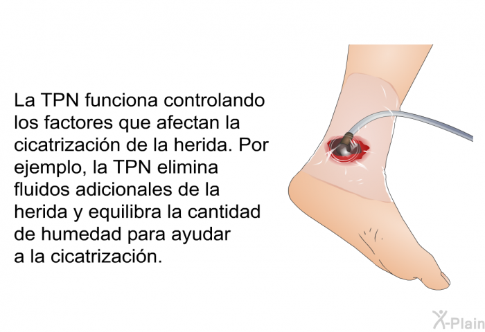 La TPN funciona controlando los factores que afectan la cicatrizacin de la herida. Por ejemplo, la TPN elimina fluidos adicionales de la herida y equilibra la cantidad de humedad para ayudar a la cicatrizacin.