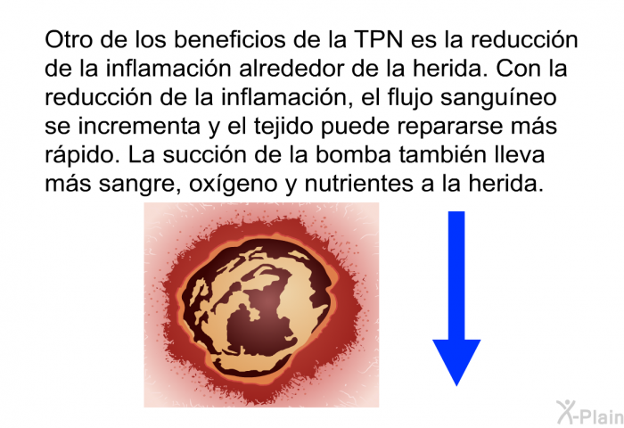 Otro de los beneficios de la TPN es la reduccin de la inflamacin alrededor de la herida. Con la reduccin de la inflamacin, el flujo sanguneo se incrementa y el tejido puede repararse ms rpido. La succin de la bomba tambin lleva ms sangre, oxgeno y nutrientes a la herida.