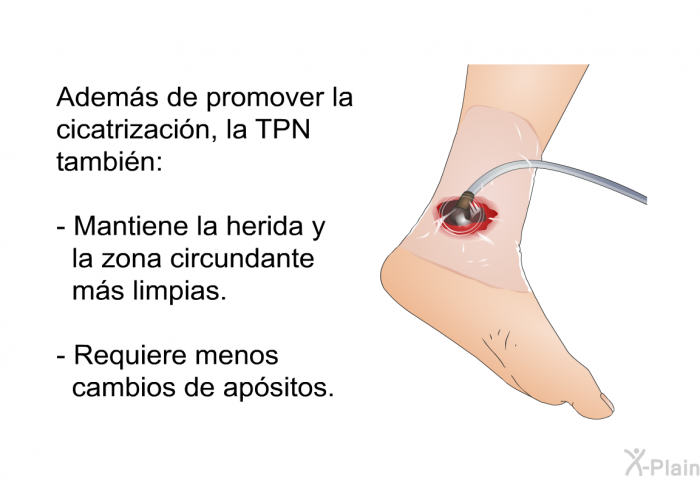 Adems de promover la cicatrizacin, la TPN tambin:  Mantiene la herida y la zona circundante ms limpias. Requiere menos cambios de apsitos.