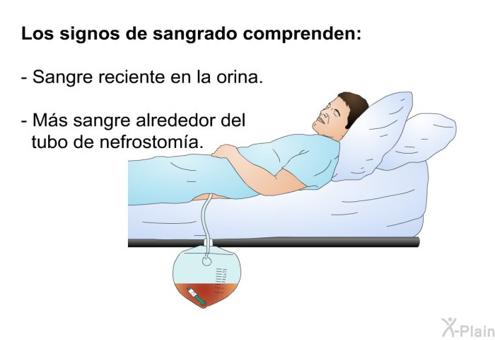 <B>Los signos de sangrado comprenden:</B>  Sangre reciente en la orina. M�s sangre alrededor del tubo de nefrostom�a.
