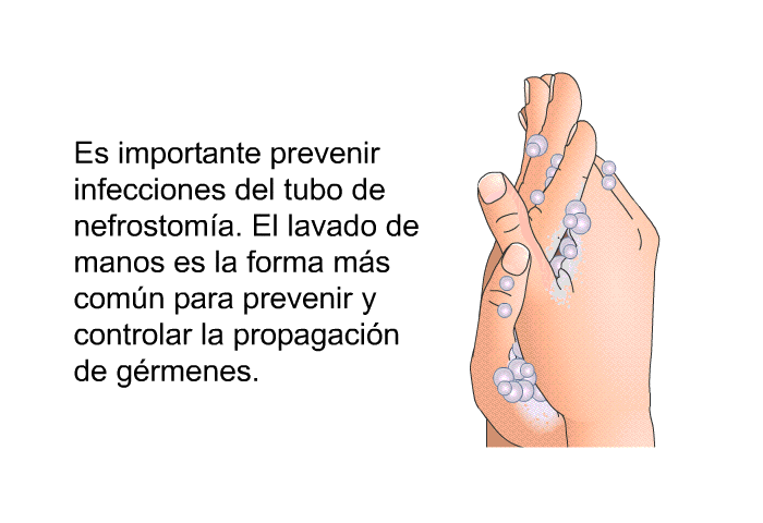 Es importante prevenir infecciones del tubo de nefrostoma. El lavado de manos es la forma ms comn para prevenir y controlar la propagacin de grmenes.