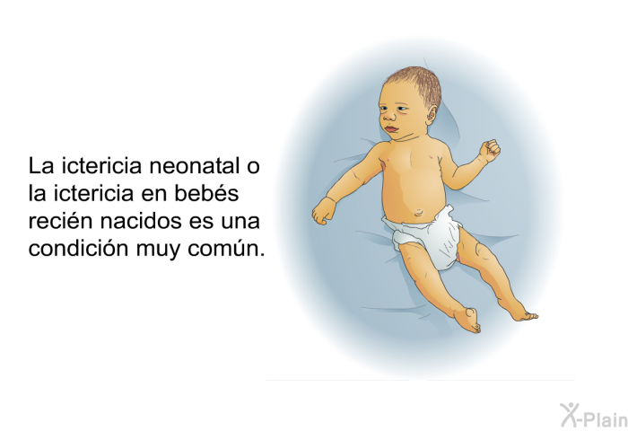 La ictericia neonatal o la ictericia en bebs recin nacidos es una condicin muy comn.
