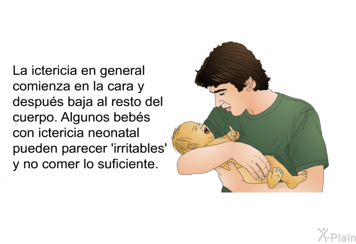 La ictericia en general comienza en la cara y despus baja al resto del cuerpo. Algunos bebs con ictericia neonatal pueden parecer  irritables' y no comer lo suficiente.