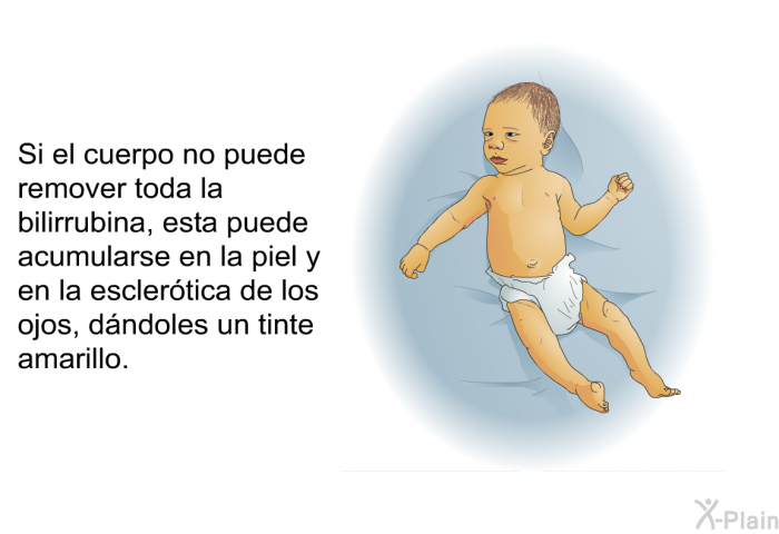 Si el cuerpo no puede remover toda la bilirrubina, esta puede acumularse en la piel y en la escler�tica de los ojos, d�ndoles un tinte amarillo.