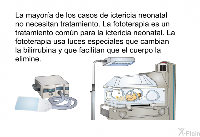 La mayor�a de los casos de ictericia neonatal no necesitan tratamiento. La fototerapia es un tratamiento com�n para la ictericia neonatal. La fototerapia usa luces especiales que cambian la bilirrubina y que facilitan que el cuerpo la elimine.