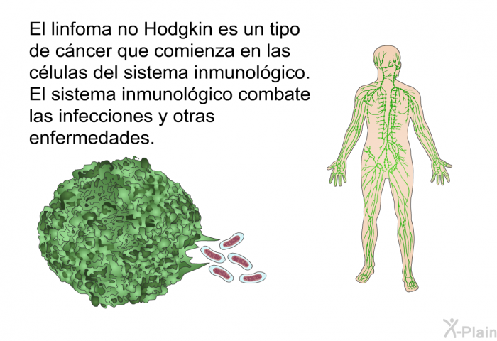 El linfoma no Hodgkin es un tipo de cncer que comienza en las clulas del sistema inmunolgico. El sistema inmunolgico combate las infecciones y otras enfermedades.