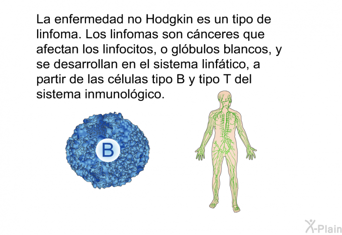 La enfermedad no Hodgkin es un tipo de linfoma. Los linfomas son cnceres que afectan los linfocitos, o glbulos blancos, y se desarrollan en el sistema linftico, a partir de las clulas tipo B y tipo T del sistema inmunolgico.
