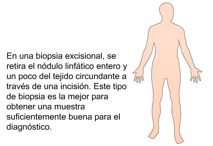 En una biopsia excisional, se retira el ndulo linftico entero y un poco del tejido circundante a travs de una incisin. Este tipo de biopsia es la mejor para obtener una muestra suficientemente buena para el diagnstico.