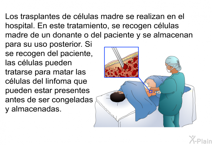 Los trasplantes de c�lulas madre se realizan en el hospital. En este tratamiento, se recogen c�lulas madre de un donante o del paciente y se almacenan para su uso posterior. Si se recogen del paciente, las c�lulas pueden tratarse para matar las c�lulas del linfoma que pueden estar presentes antes de ser congeladas y almacenadas.
