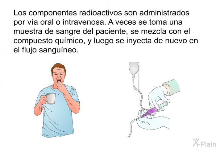 Los componentes radioactivos son administrados por va oral o intravenosa. A veces se toma una muestra de sangre del paciente, se mezcla con el compuesto qumico, y luego se inyecta de nuevo en el flujo sanguneo.
