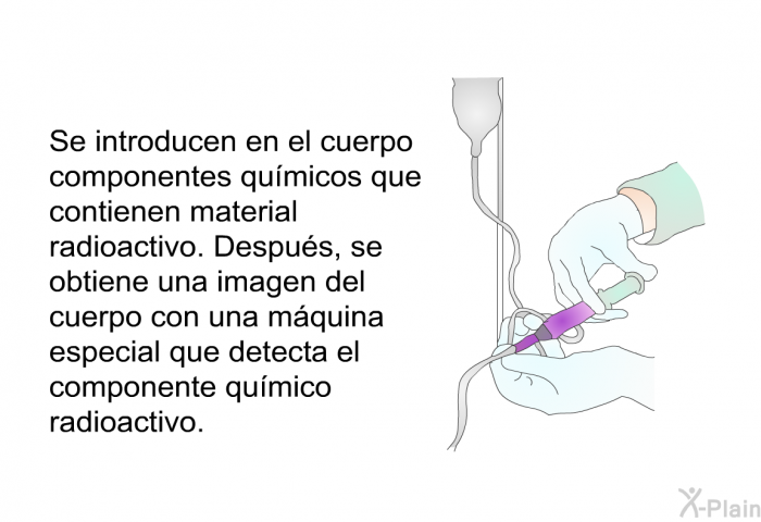 Se introducen en el cuerpo componentes qumicos que contienen material radioactivo. Despus, se obtiene una imagen del cuerpo con una mquina especial que detecta el componente qumico radioactivo.