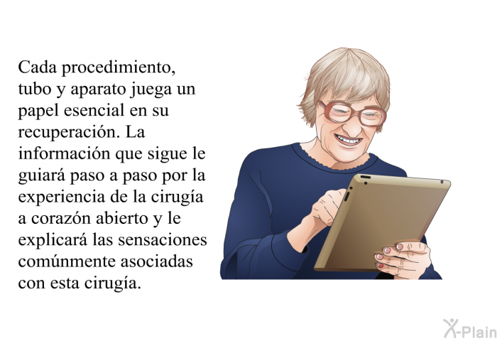 Cada procedimiento, tubo y aparato juega un papel esencial en su recuperacin. La informacin que sigue le guiar paso a paso por la experiencia de la ciruga a corazn abierto y le explicar las sensaciones comnmente asociadas con esta ciruga.