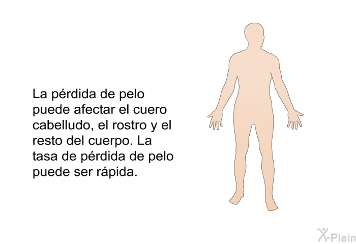 La prdida de pelo puede afectar el cuero cabelludo, el rostro y el resto del cuerpo. La tasa de prdida de pelo puede ser rpida.