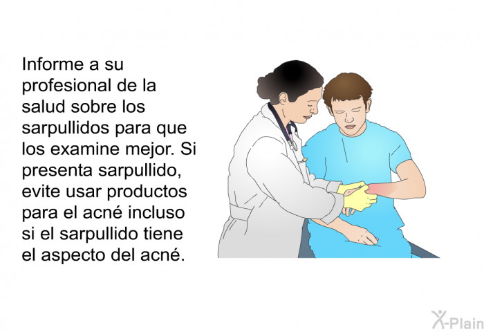 Informe a su profesional de la salud sobre los sarpullidos para que los examine mejor. Si presenta sarpullido, evite usar productos para el acn incluso si el sarpullido tiene el aspecto del acn.