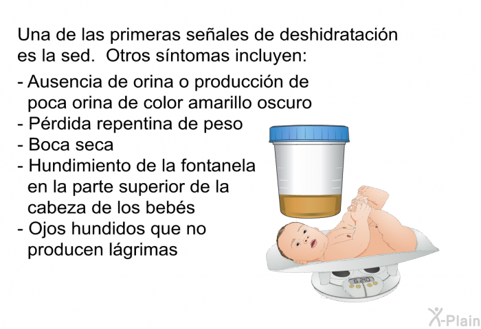 Una de las primeras seales de deshidratacin es la sed. Otros sntomas incluyen:  Ausencia de orina o produccin de poca orina de color amarillo oscuro Prdida repentina de peso Boca seca Hundimiento de la fontanela en la parte superior de la cabeza de los bebs Ojos hundidos que no producen lgrimas