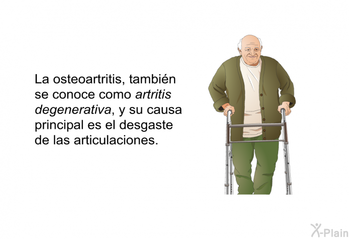 La osteoartritis, tambin se conoce como <I>artritis degenerativa</I>, y su causa principal es el desgaste de las articulaciones.