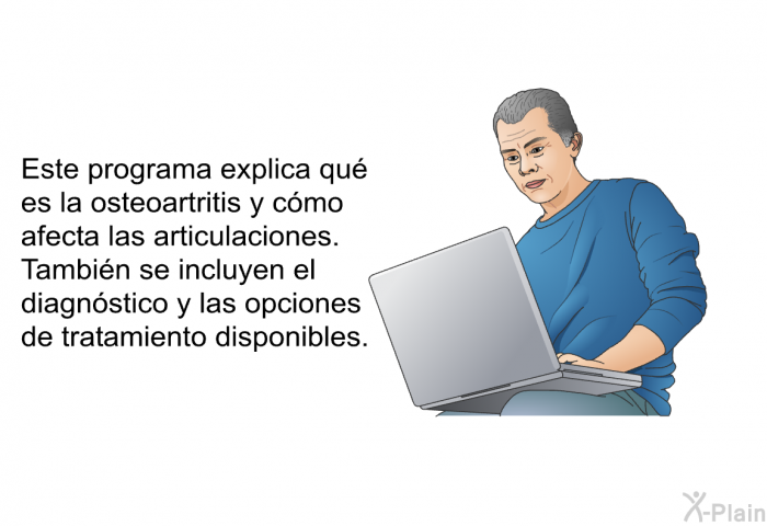 Esta informacin acerca de su salud explica qu es la osteoartritis y cmo afecta las articulaciones. Tambin se incluyen el diagnstico y las opciones de tratamiento disponibles.