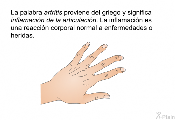 La palabra <I>artritis </I>proviene del griego<I> </I>y significa <I>inflamacin de la articulacin</I>. La inflamacin es una reaccin corporal normal a enfermedades o heridas.