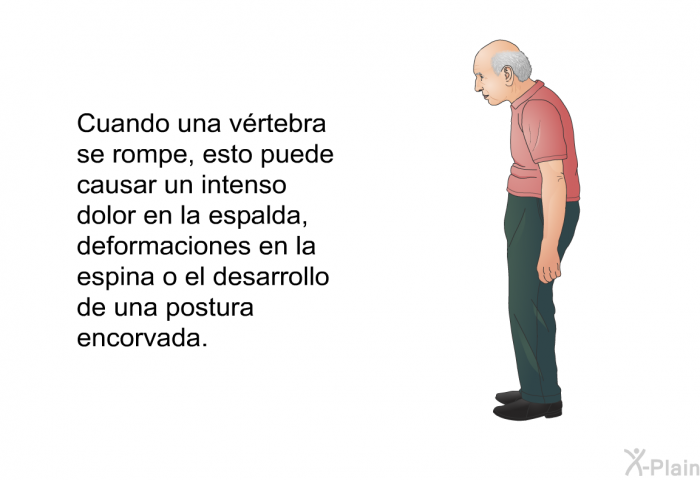 Cuando una vrtebra se rompe, esto puede causar un intenso dolor en la espalda, deformaciones en la espina o el desarrollo de una postura encorvada.