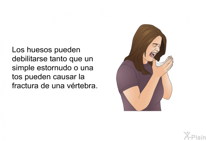 Los huesos pueden debilitarse tanto que un simple estornudo o una tos pueden causar la fractura de una vrtebra.